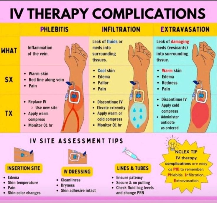 IV Extravasation Management